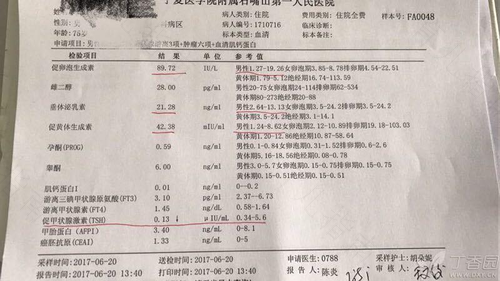 fsh高了怎么办 fsh高了怎么办