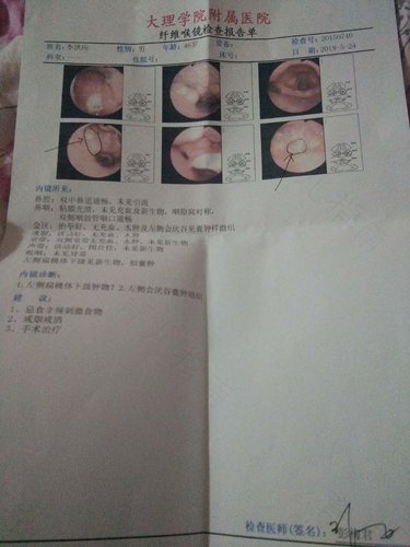 喉咙长了个囊肿怎么办图 喉咙长了个囊肿怎么办图