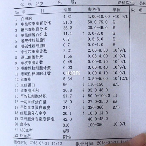 怎么能检查出贫血 怎么能检查出贫血