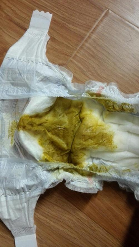 拉肚子都是水怎么回事 拉肚子都是水怎么回事