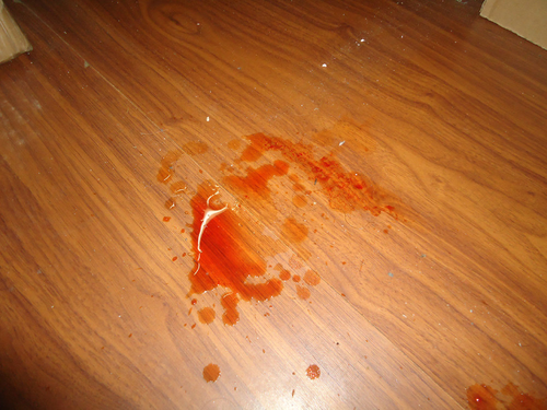 男的拉尿出血怎么回事 男的拉尿出血怎么回事