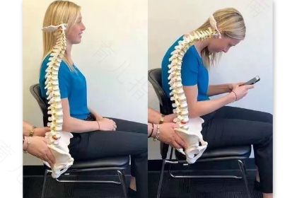 脊椎前倾怎么办 脊椎前倾怎么办