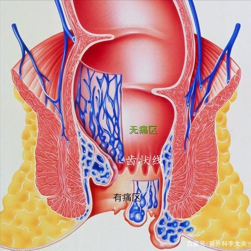 痔疮手术后第二天特别痛