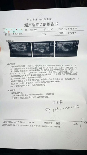 胸部疼痛应该做什么检查 胸部疼痛应该做什么检查