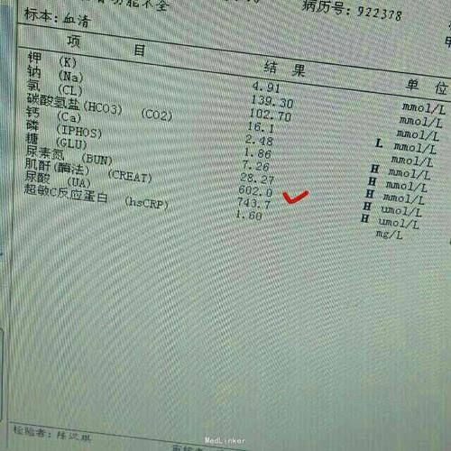 女性肌酐低怎么调理 女性肌酐低怎么调理