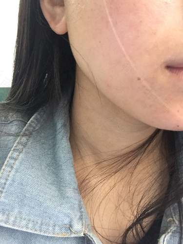 经常过敏对身体有害吗儿童