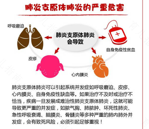 感冒咳嗽会引起肺炎吗 感冒咳嗽会引起肺炎吗