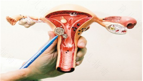 做人流手术需要多久时间 做人流手术需要多久时间