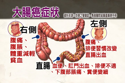 肠癌会引起皮肤哪些症状 肠癌会引起皮肤哪些症状