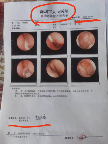 宝宝怎么确诊鼻窦炎 宝宝怎么确诊鼻窦炎