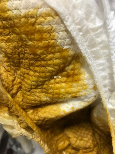 感冒又拉稀怎么办 感冒又拉稀怎么办