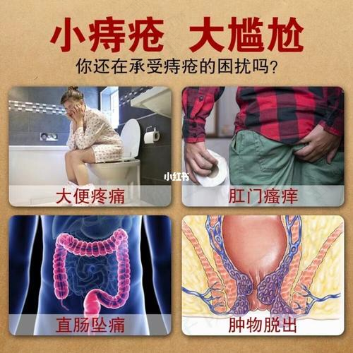 痔疮会引起尿频尿急吗女 痔疮会引起尿频尿急吗女