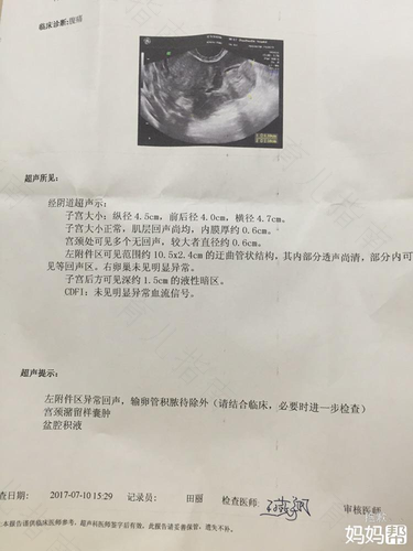输卵管囊肿怎么能治好博客 输卵管囊肿怎么能治好博客