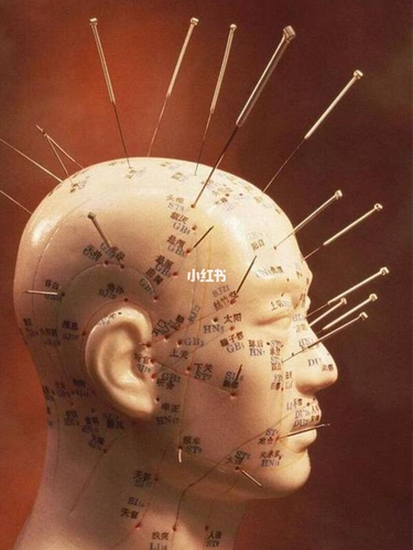 三叉神经在什么位置图 三叉神经在什么位置图