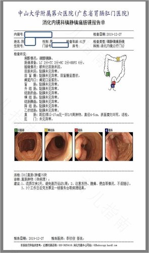肛门长息肉是怎么回事 肛门长息肉是怎么回事