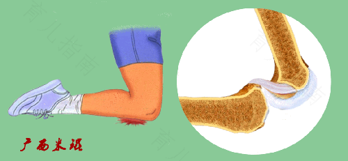 小腿韧带拉伤怎么办恢复快 小腿韧带拉伤怎么办恢复快