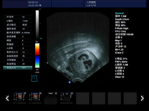 可视人流会不会漏吸 可视人流会不会漏吸