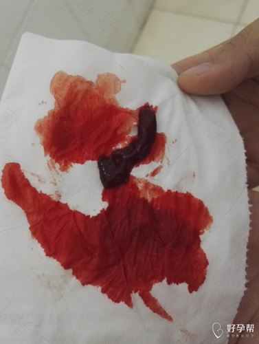 肚子疼痛便血是怎么回事 肚子疼痛便血是怎么回事