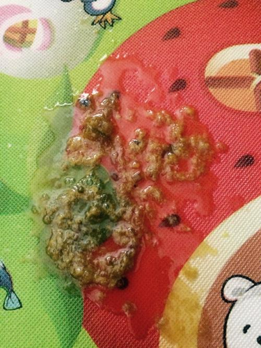 大人不消化拉肚子怎么办呢 大人不消化拉肚子怎么办呢