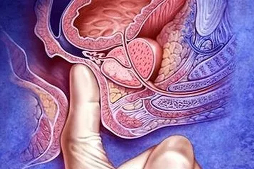 痔疮为什么一直流血怎么办 痔疮为什么一直流血怎么办