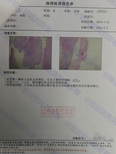 癌症早期能查出来吗? 癌症早期能查出来吗?