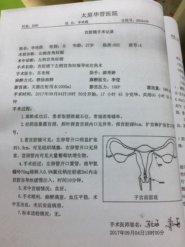 宫颈管积液是什么病严重吗 宫颈管积液是什么病严重吗