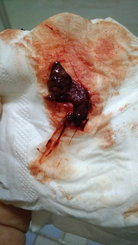 女孩半个月来一次月经是什么原因 女孩半个月来一次月经是什么原因