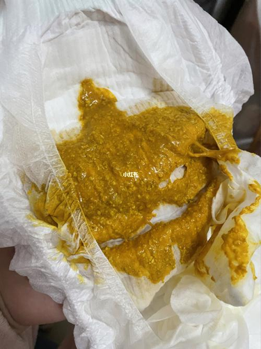 宝宝吃完就拉是怎么回事 宝宝吃完就拉是怎么回事