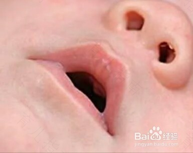 鼻孔痒是怎么回事儿
