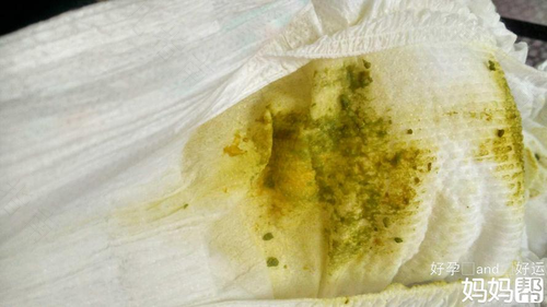 腹泻后三天没有拉大便怎么办 腹泻后三天没有拉大便怎么办