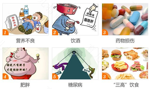 什么原因导致脂肪肝高 什么原因导致脂肪肝高