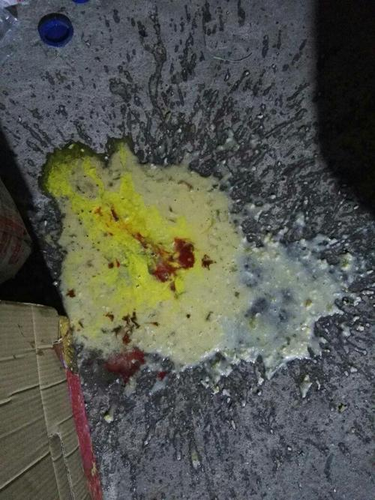 吐黄水苦水是怎么回事吃什么药 吐黄水苦水是怎么回事吃什么药