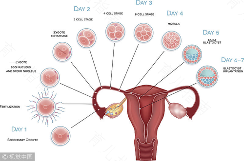 盆腔炎和子宫内膜炎一样吗 盆腔炎和子宫内膜炎一样吗