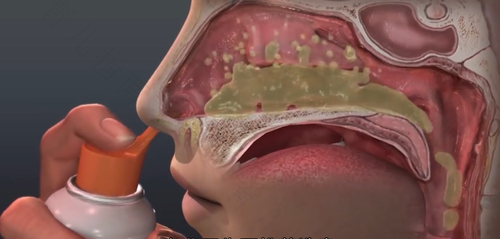 鼻子每天都很多鼻屎怎么回事