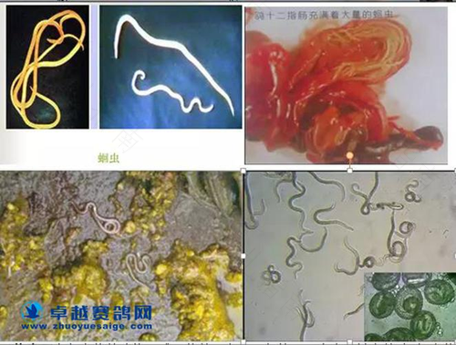 查大便可以查出是否有蛔虫吗 查大便可以查出是否有蛔虫吗