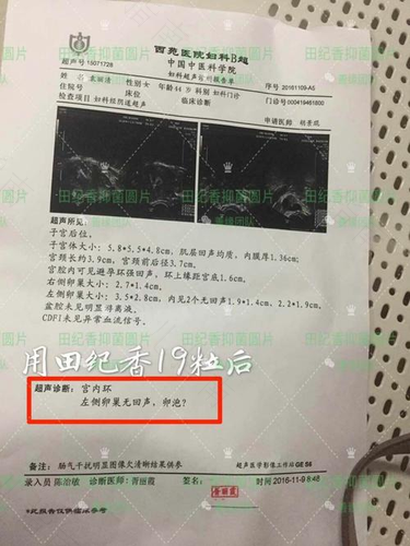 宫颈囊肿可以扎破挤出来吗 宫颈囊肿可以扎破挤出来吗