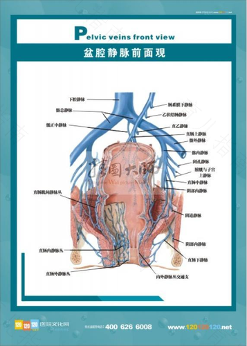 盆腔静脉曲张怎么治疗