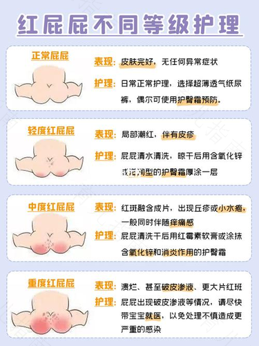 拉稀导致红屁股怎么办 拉稀导致红屁股怎么办