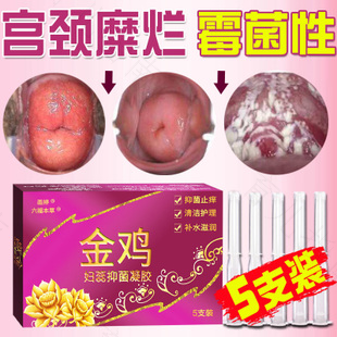 宫颈口痒痒怎么办