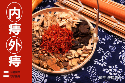 肉痔疮怎么治疗方法 肉痔疮怎么治疗方法