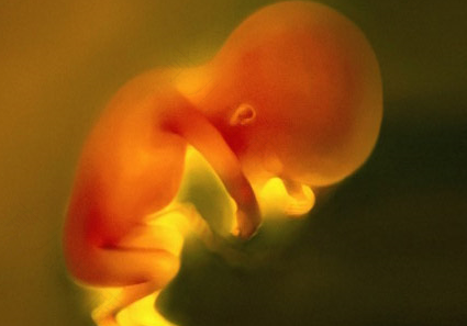 胎儿神经管缺陷怎么办