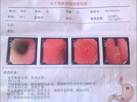 胃出血有什么症状表现 胃出血有什么症状表现