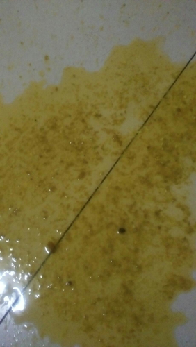 呕吐 拉肚子怎么回事 呕吐 拉肚子怎么回事