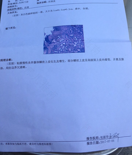 宫颈病变一定要锥切吗? 宫颈病变一定要锥切吗?