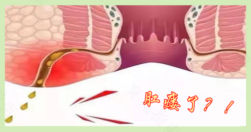 宝宝肛门周围红怎么回事