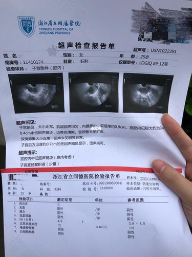 有子宫内膜息肉怎么办 有子宫内膜息肉怎么办