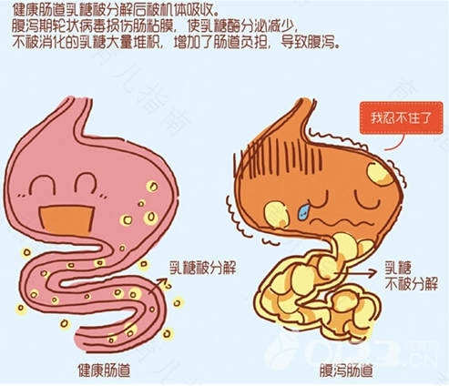 吃什么东西容易拉肚子排便 吃什么东西容易拉肚子排便