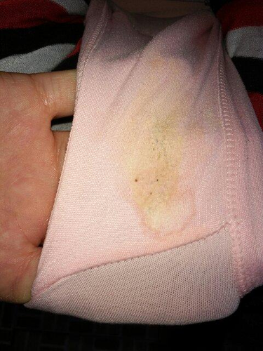 乳晕小是为什么 乳晕小是为什么