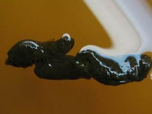 为什么大便不成条状 为什么大便不成条状