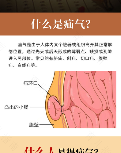 男人疝气需要怎么治疗 男人疝气需要怎么治疗